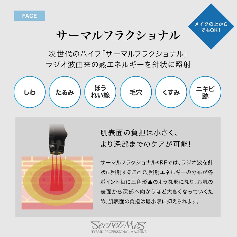 サーマルフラクショナルの説明